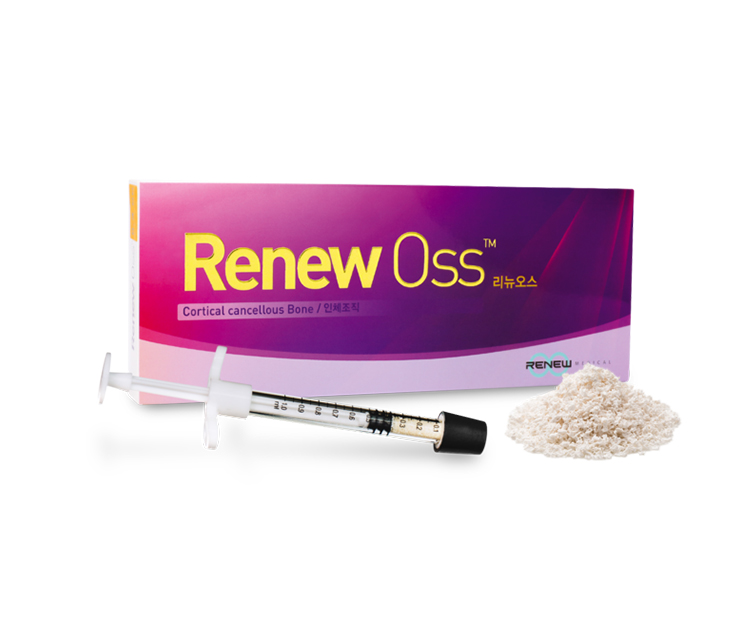 오산치과 서울수려한치과 Renew OSS 동종골