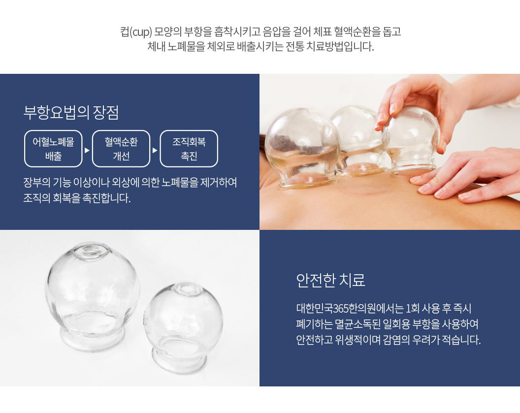 대한민국365한의원_침술