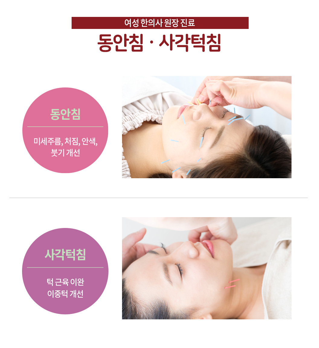 대한민국365한의원_안면침(동안침), 사각턱침