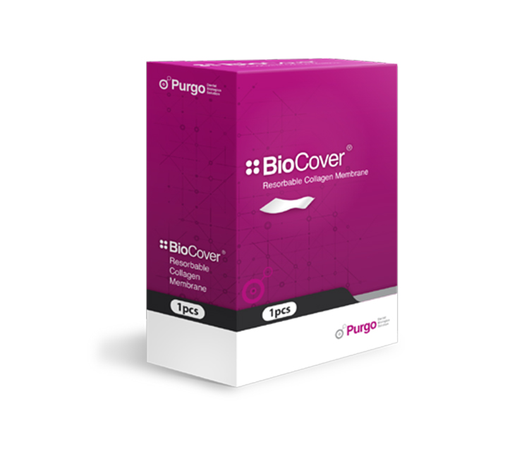 오산치과 서울수려한치과 푸르고 BioCover 멤브레인