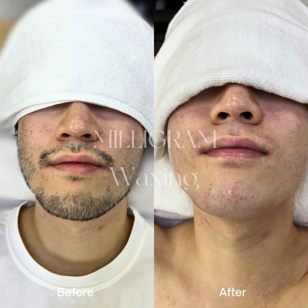 [경북 구미] 밀리그램스칼프X모먼트스킨 체험단