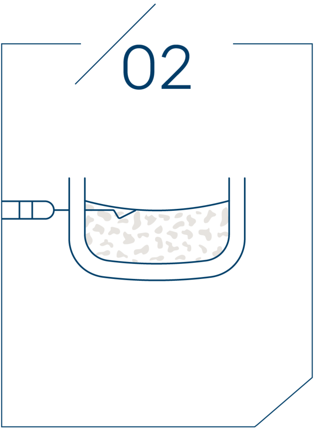 <strong>2단계 점막을 들어올리기</strong>
