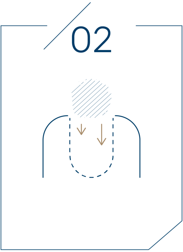 <strong>2단계 뼈이식재 충전</strong>