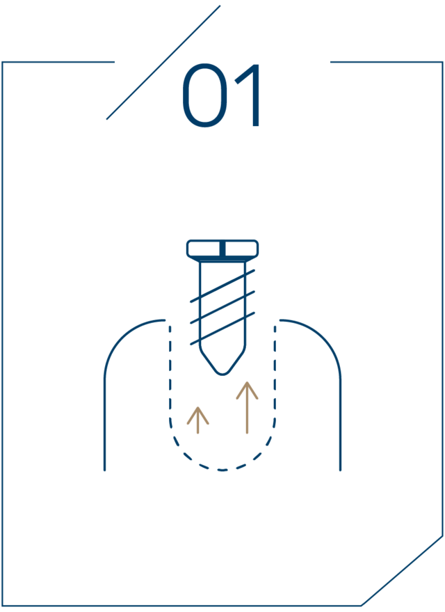 <strong>1단계 임플란트 제거</strong>