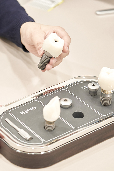 오정구-삼정동-연세미소애치과-상악동거상술-임플란트모형