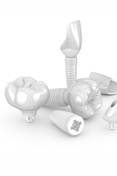 오정구-삼정동-연세미소애치과-임플란트-심미임플란트모형