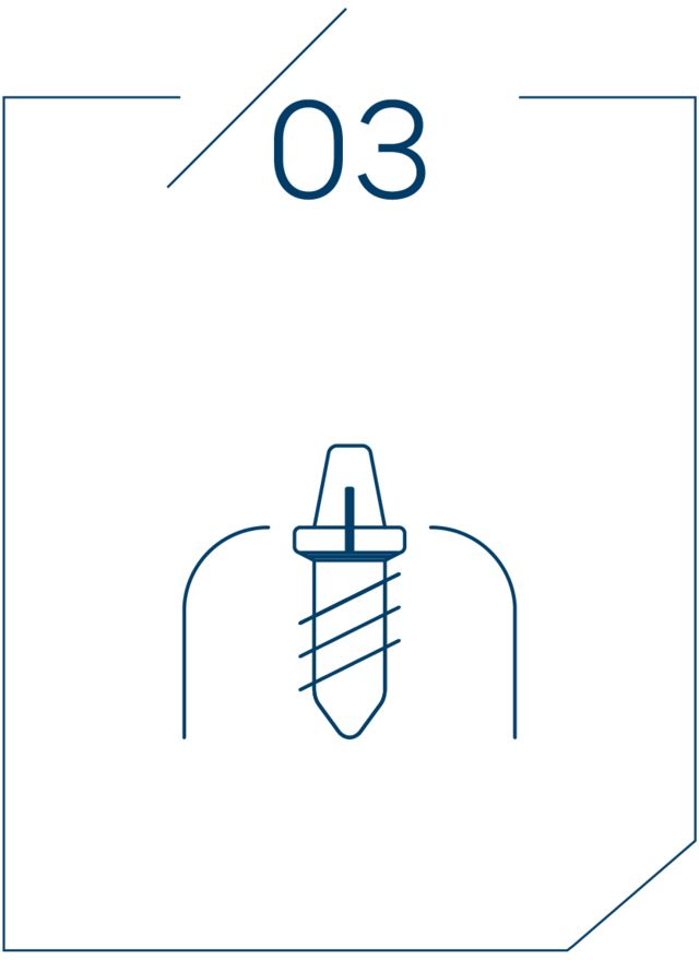 <strong>3단계 치유 기간 후 식립</strong>