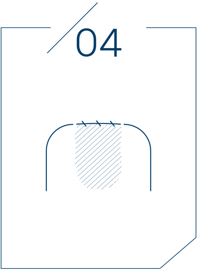 <strong>4단계 봉합 후 식립</strong>