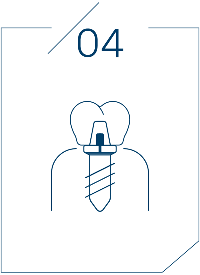 <strong>4단계 보철물 결합</strong>