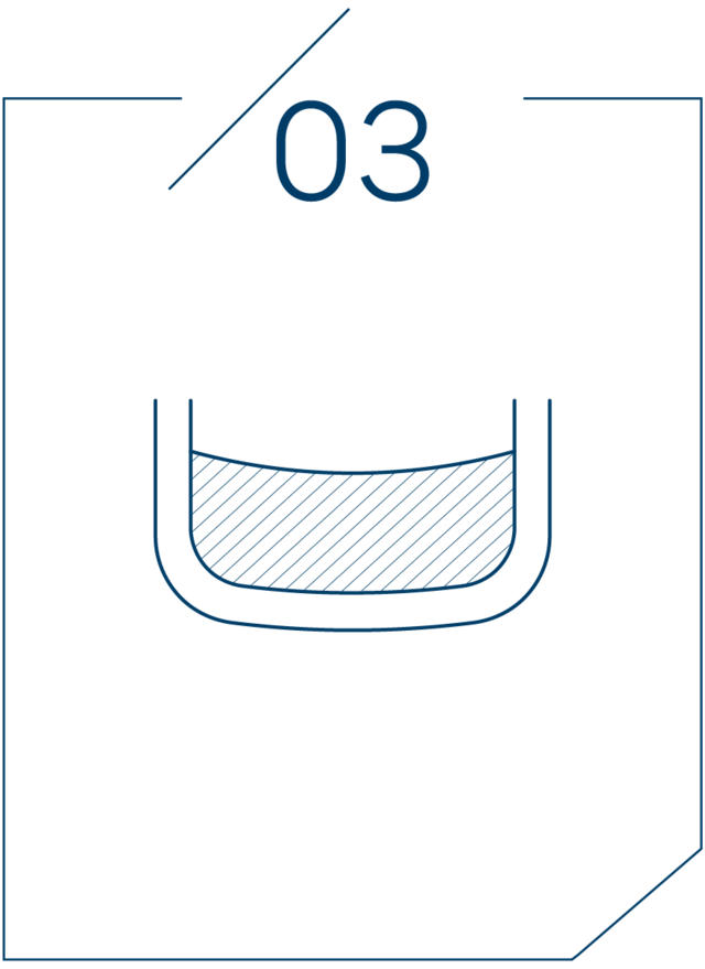 <strong>3단계 뼈이식 진행</strong>