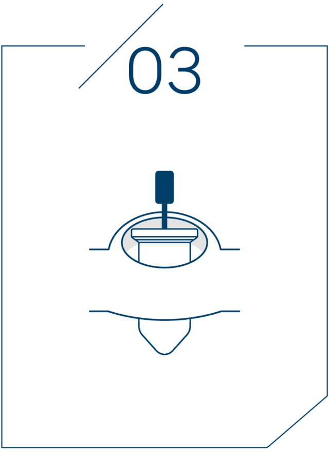 <strong>3단계 가이드 장착 후 식립</strong>