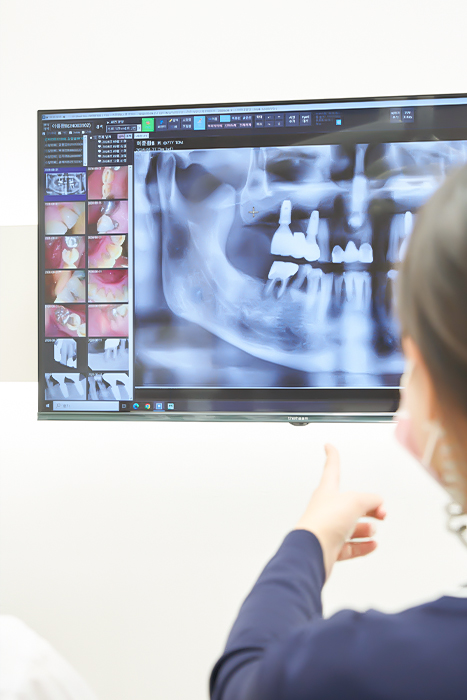 오정구-삼정동-연세미소애치과-임플란트재수술-진료