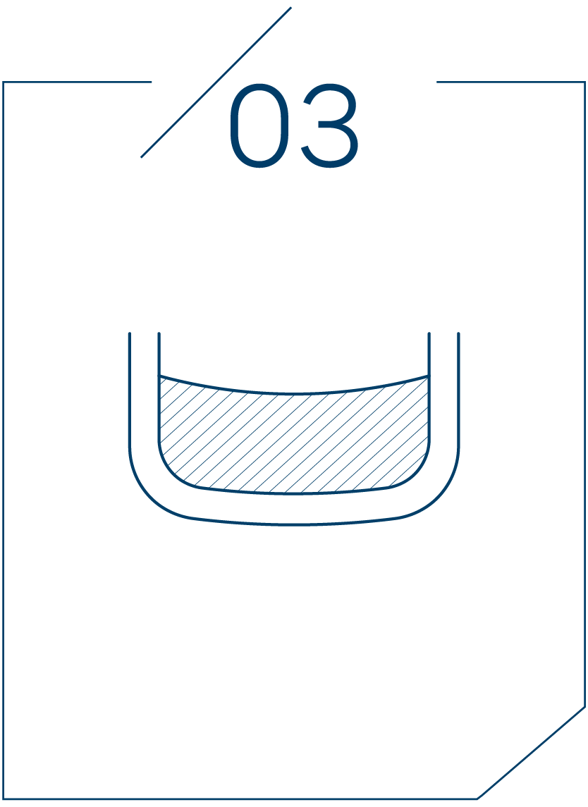 <strong>3단계 뼈이식 진행</strong>