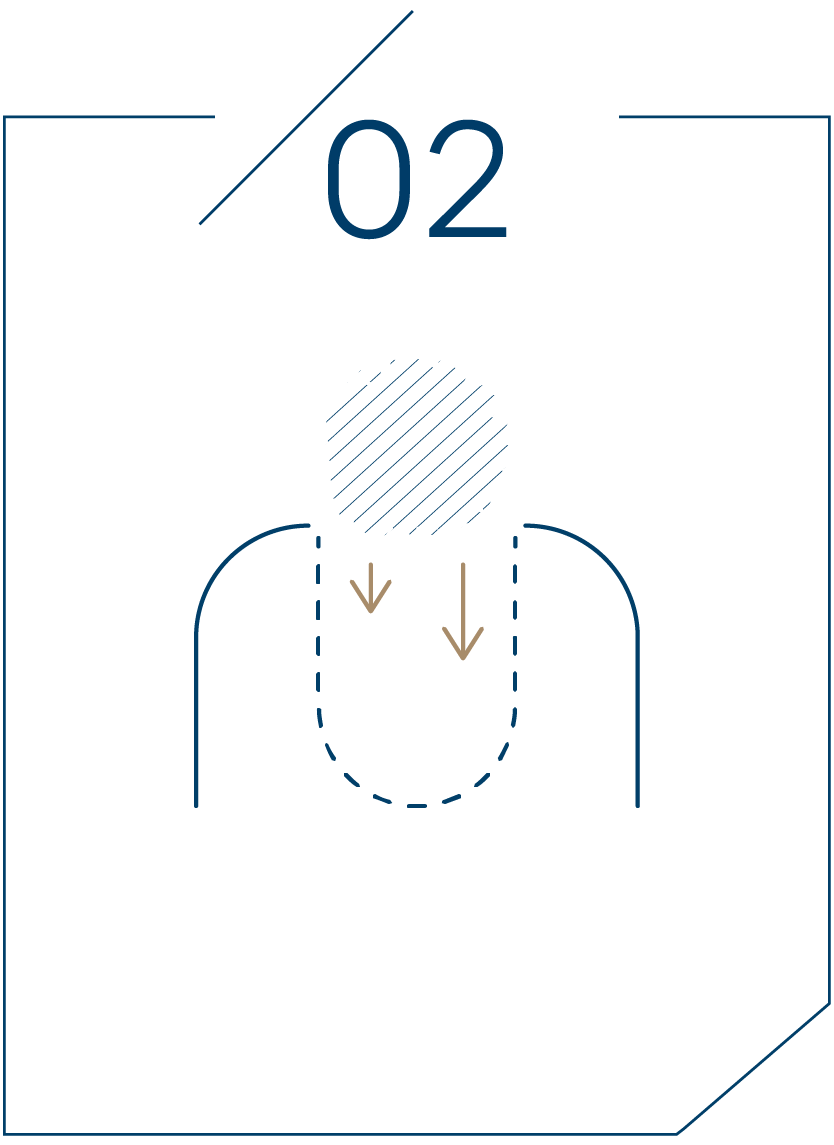 <strong>2단계 뼈이식재 충전 </strong>