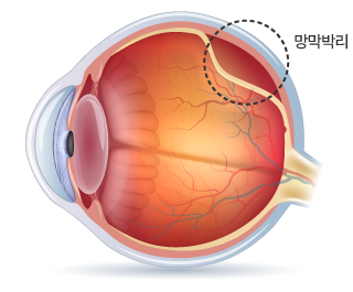 retina_eyes05