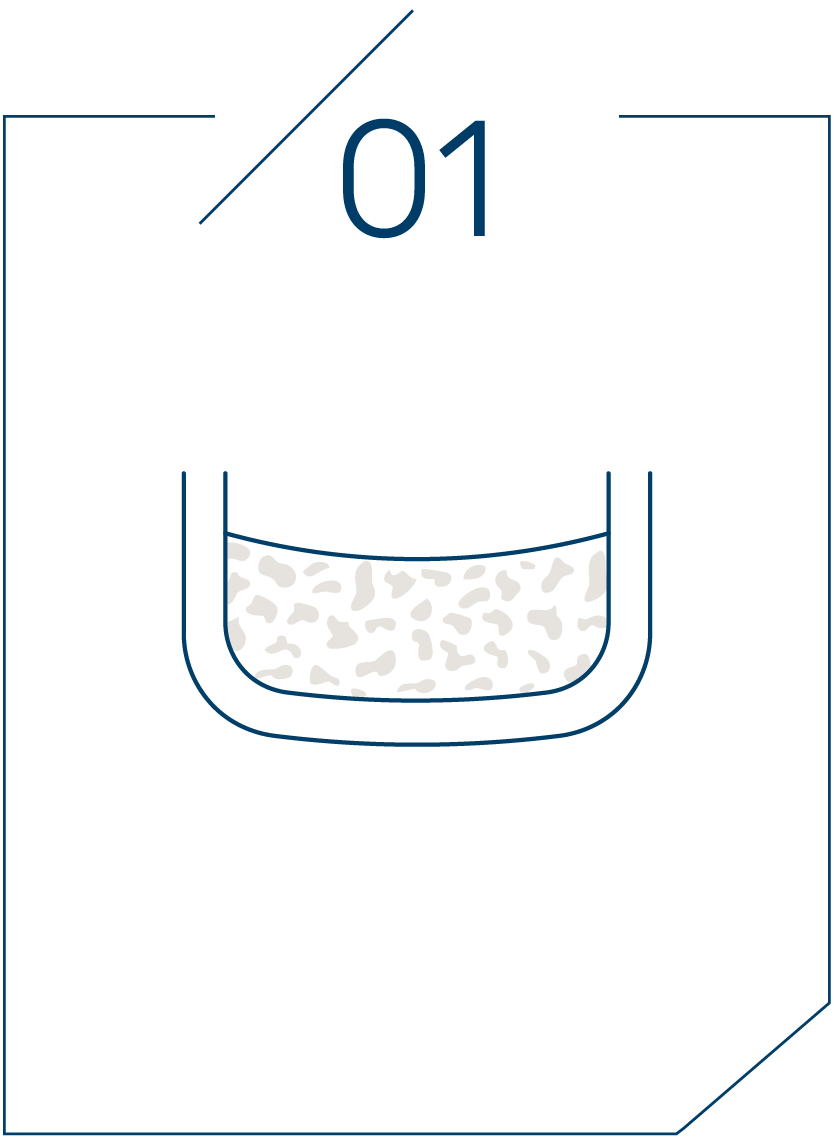 <strong>1단계 치조골 높이 확인</strong>