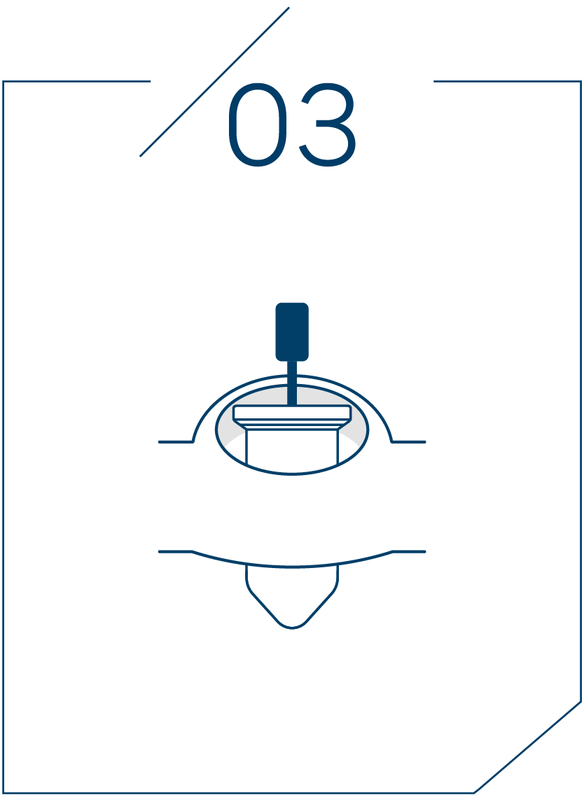 <strong>3단계 가이드 장착 후 식립</strong>