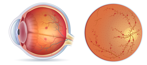 retina_eyes04