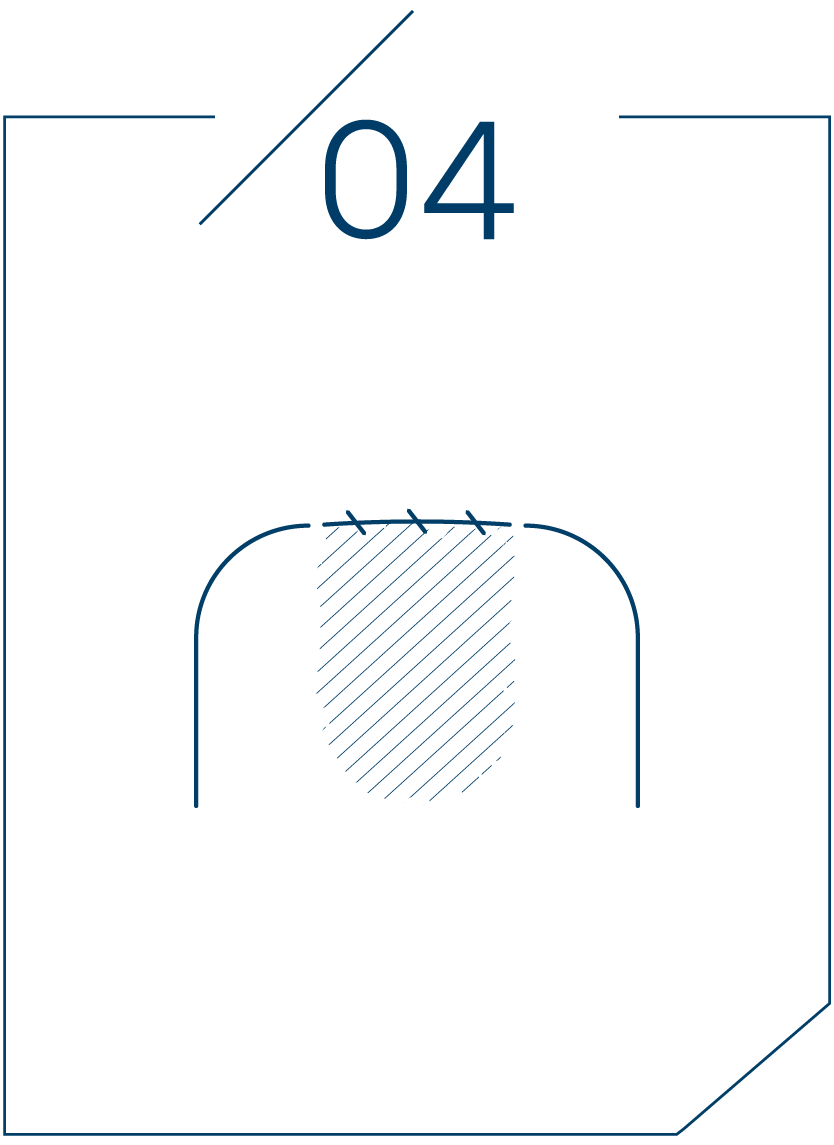 <strong>4단계 봉합 후 식립</strong>