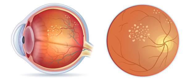 retina_eyes03