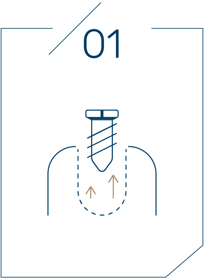 <strong>1단계 임플란트 제거</strong>