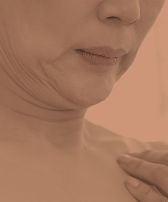 <p style="font-weight: 700;">이중 턱 <span class="mobile_textBreak">개선</span></p>