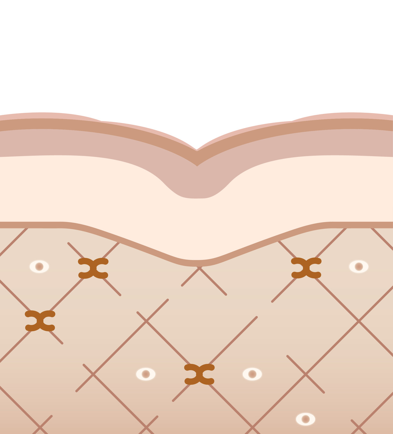 DA Dosan thermage FLX Customized Treated, Loose Collagen