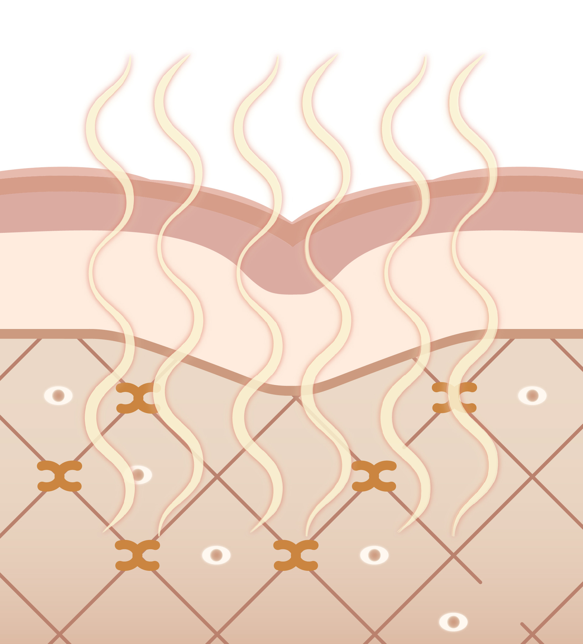 Through Thermage radiofrequency treatment