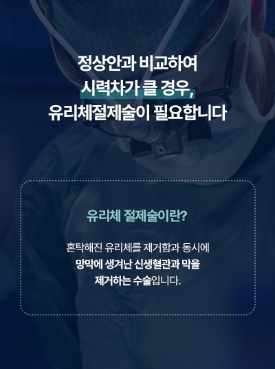 유리체 절제술이 필요한 경우