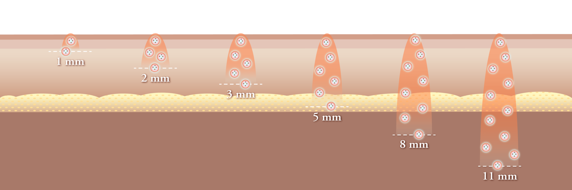 Kondisi dan masalah kulit setiap individu berbeda. Dengan berbagai handpiece dari Tune dan pengaturan energi yang presisi, kami memberikan perawatan yang dioptimalkan untuk setiap area. Dengan demikian, Anda dapat merasakan lifting dan perbaikan elastisitas yang lebih aman dan efektif