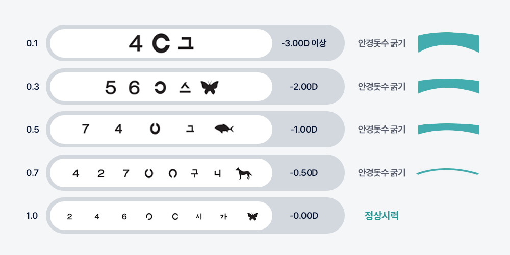 마이오가드가 가능한 시력