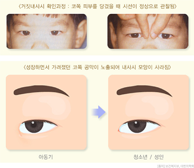 clinic_eyes03