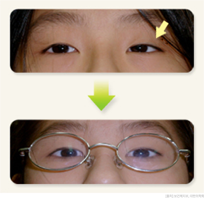 clinic_eyes05