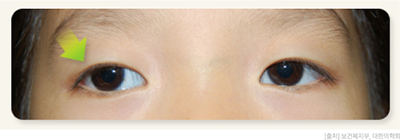 clinic_eyes02