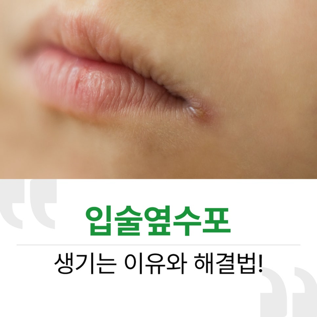 입술 옆 수포 생기는 이유와 해결법! : 닥터프렌드