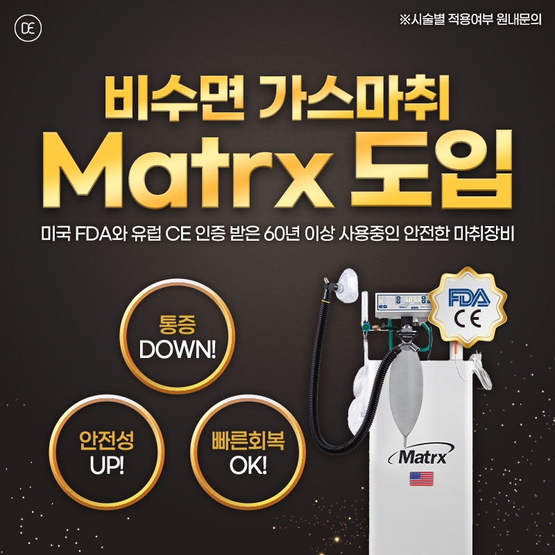 비수면가스마취
