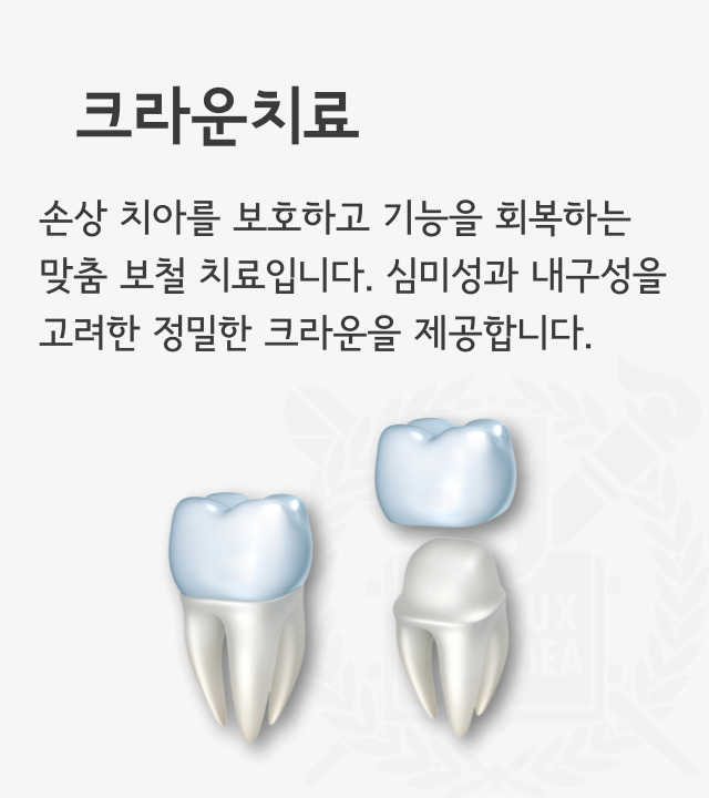 손상된 치아를 보호하고 기능을 회복하는 맞춤 보철치료입니다. 심미성과 내구성을 고려한 정밀한 크라운을 제공합니다.
