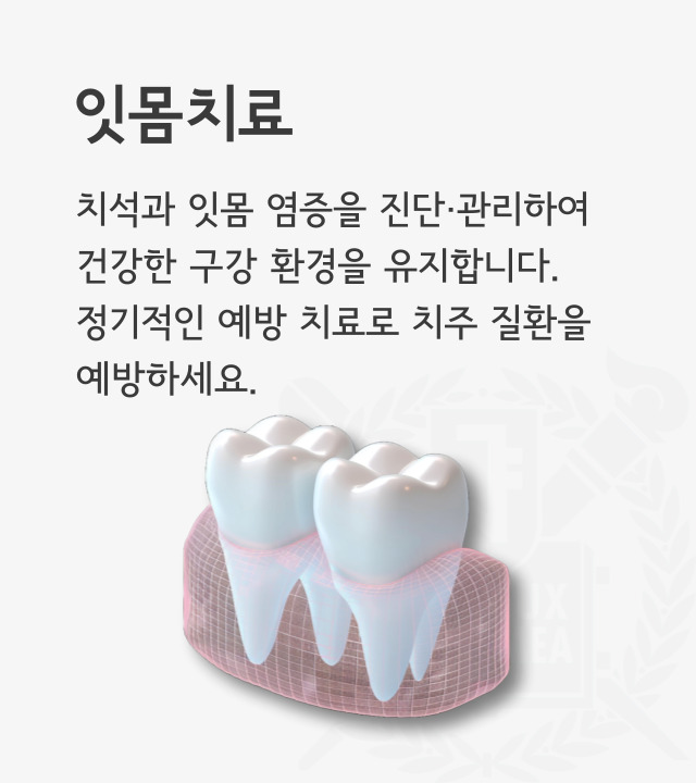 치석과 잇몸 염증을 진단 및 관리하여 건강한 구강환경을 유지합니다. 정기적인 예방치료로 치주 질환을 예방하세요