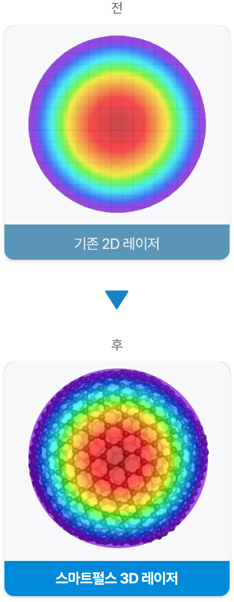<alt=스마트펄스 3d레이저>
