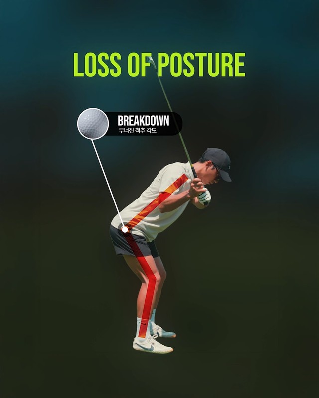 Loss of Posture