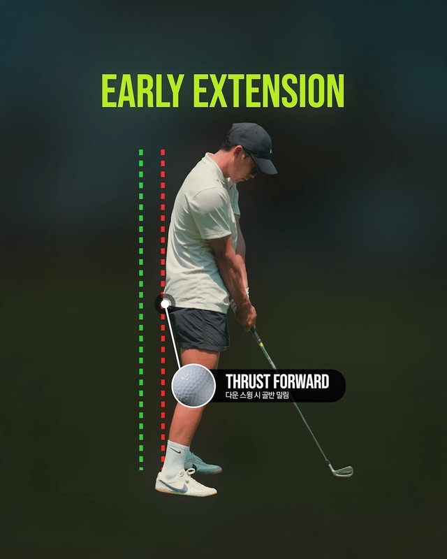 Early Extension