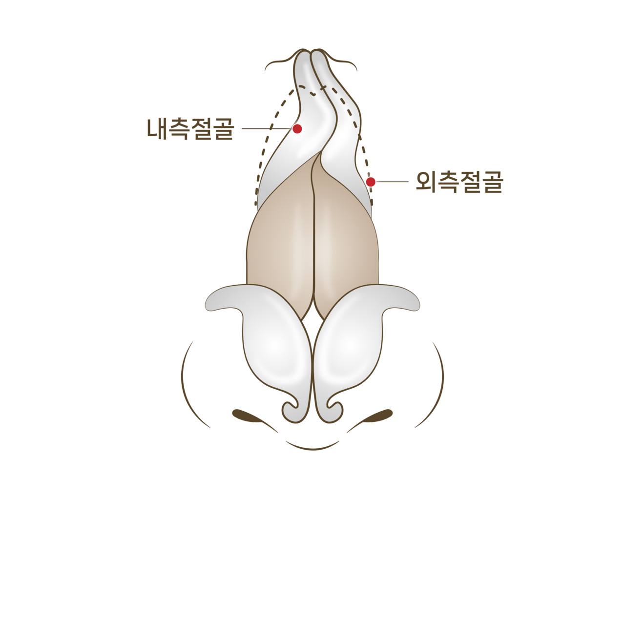 바르게 교정<br>