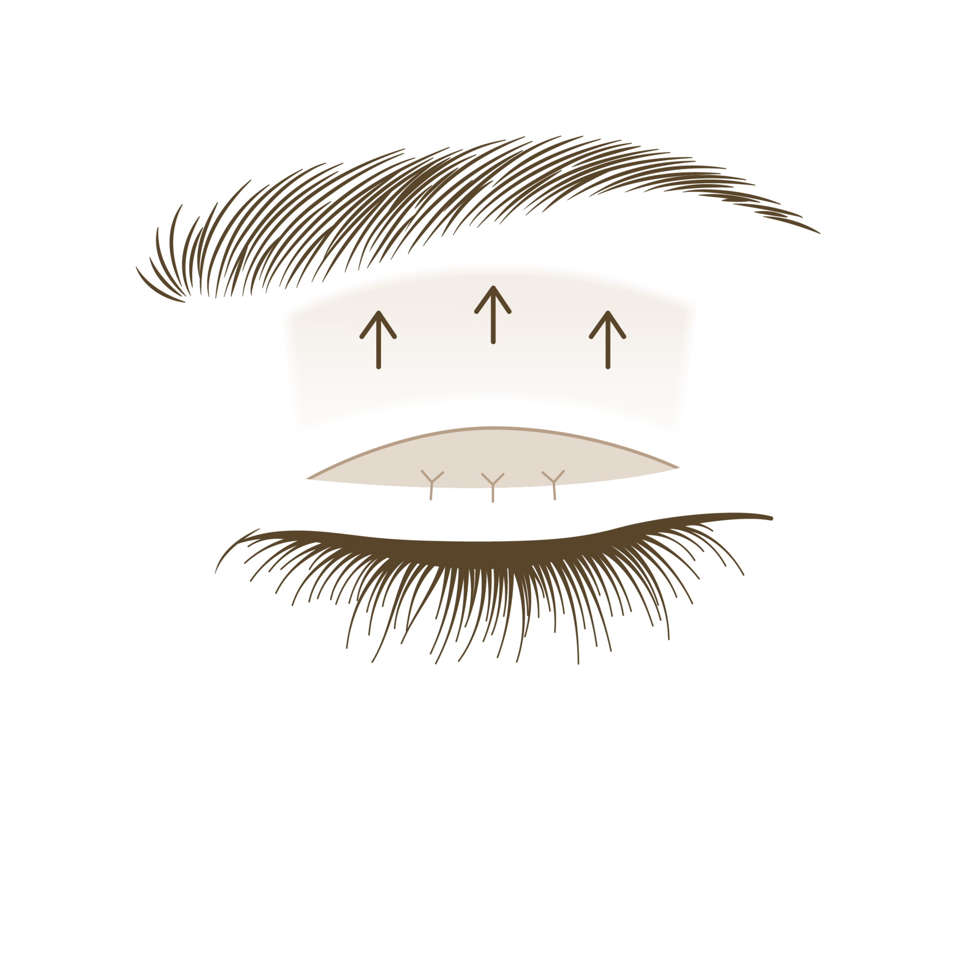 <p style="text-align: center;"><span style="font-size: 14px;">눈꺼풀 올림근육 강화</span></p>