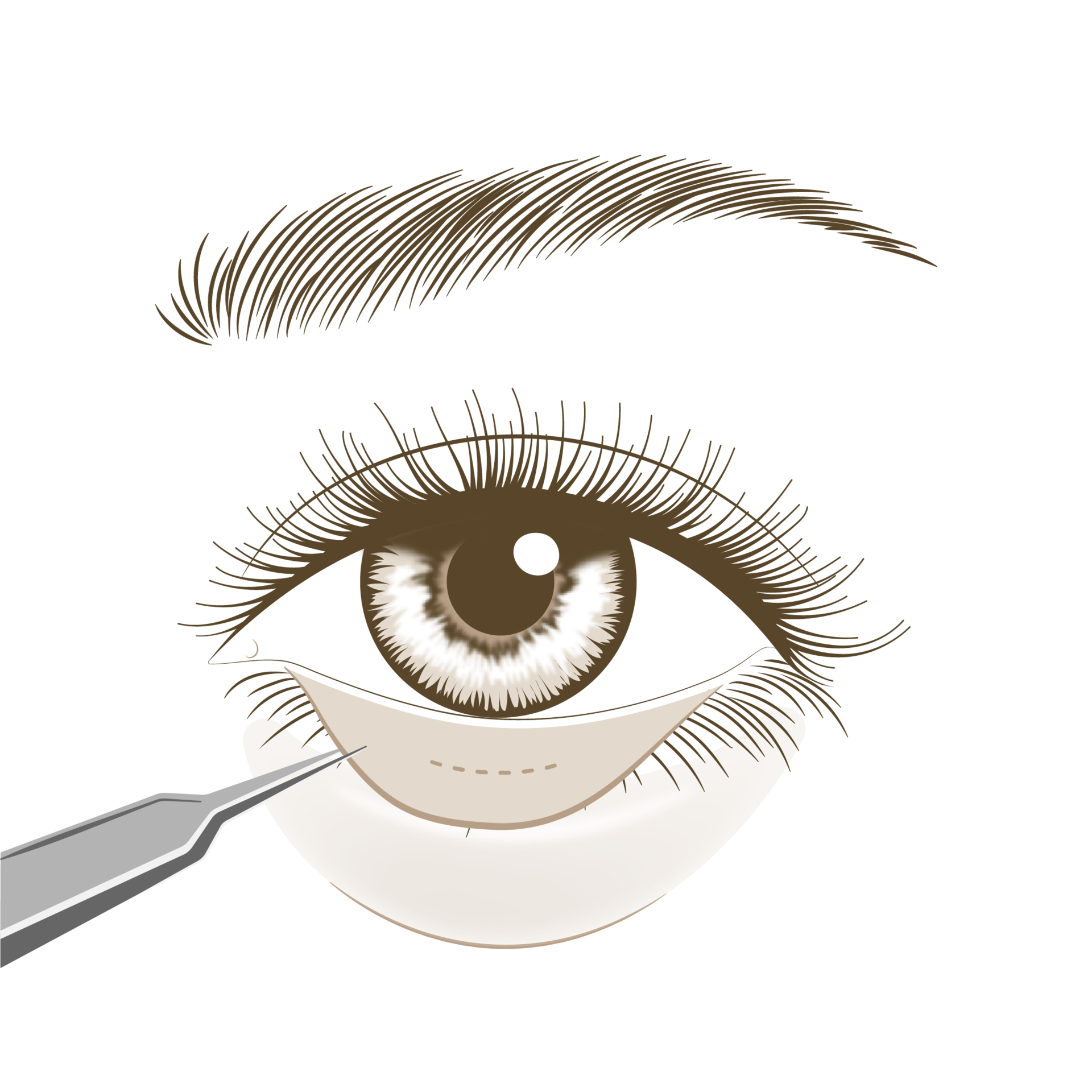 <p style="text-align: center;"><span style="font-size: 14px;">눈 안쪽 결막 레이저</span></p>