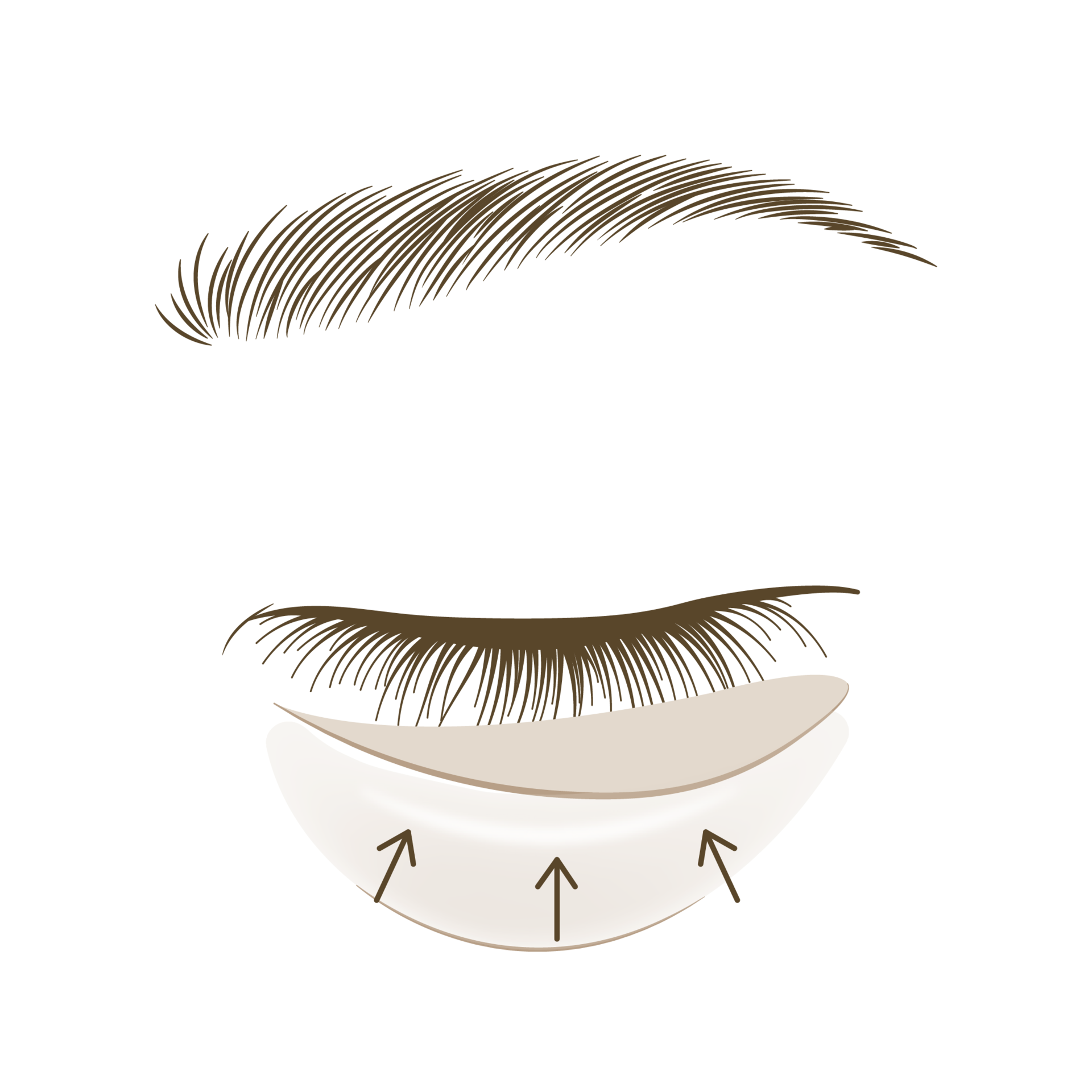 <p style="text-align: center;"><span style="font-size: 14px;">근육 리프팅</span></p>