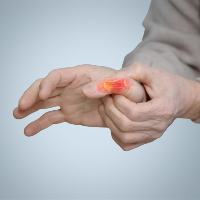 류마티스관절염