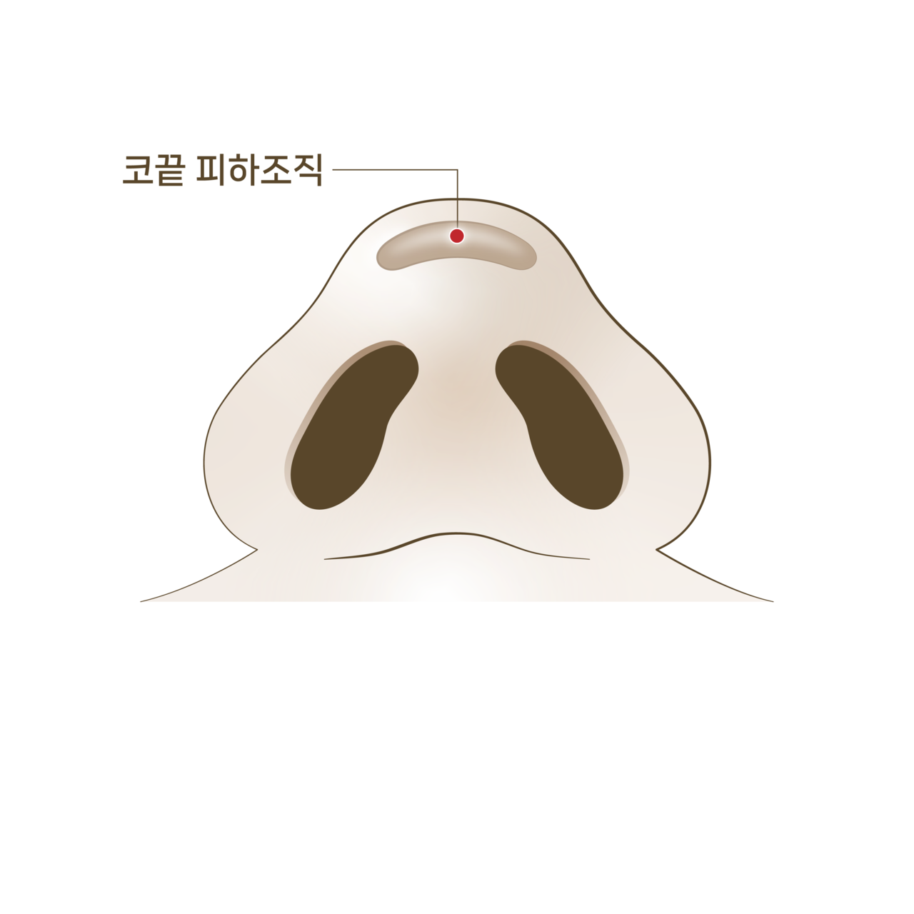수술 전<br>