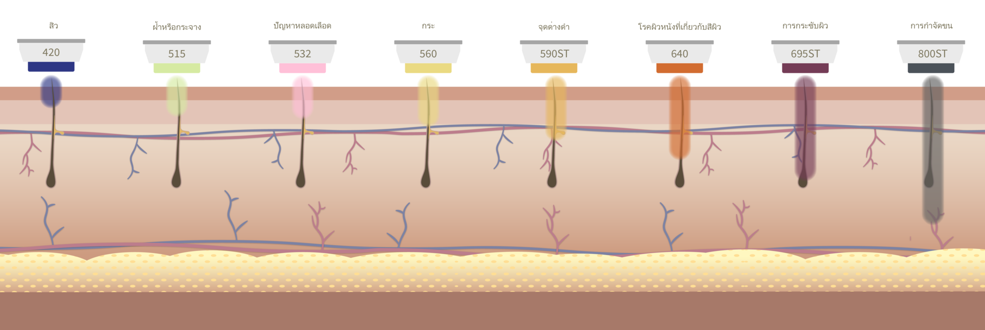 Filter Smart BBL ที่ปรับเฉพาะบุคคล