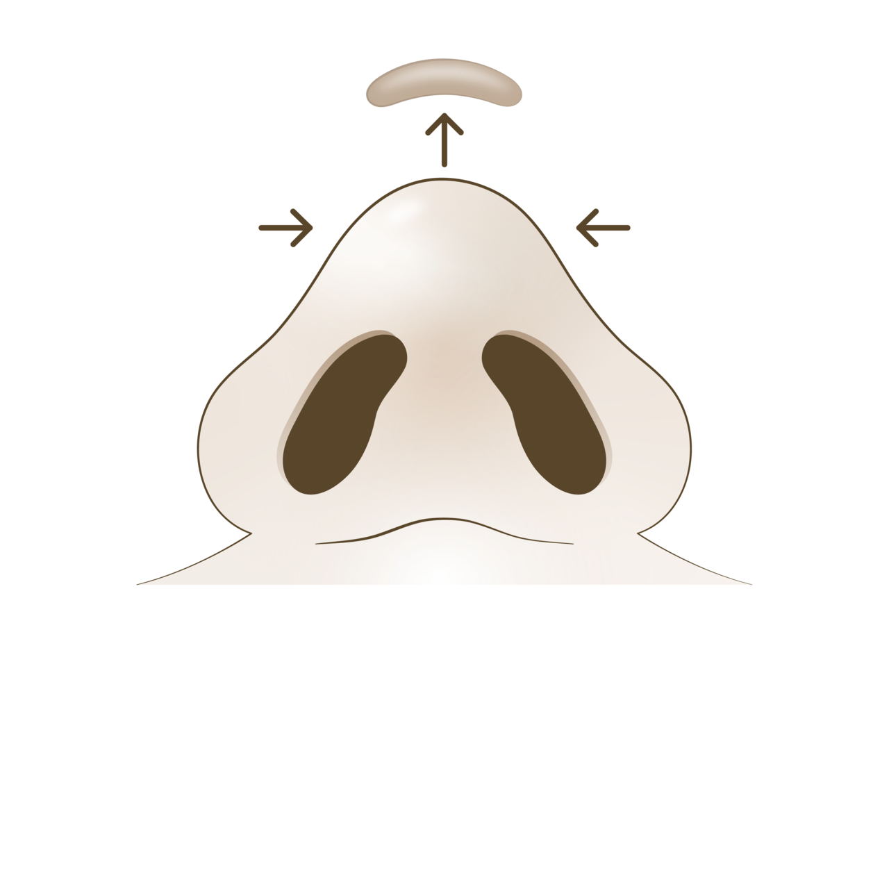 코끝 피하조직 제거<br>