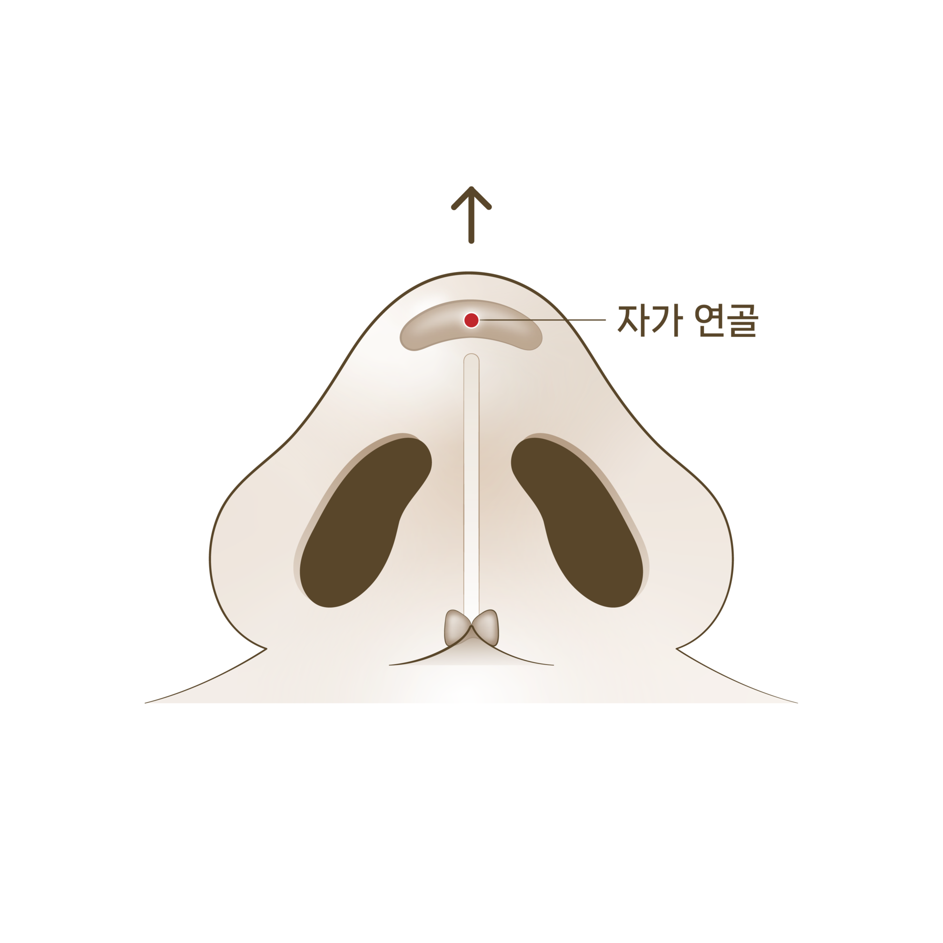 <p style="text-align: center;"><span style="font-size: 14px;">자가 연골로 코끝 높이기</span></p>